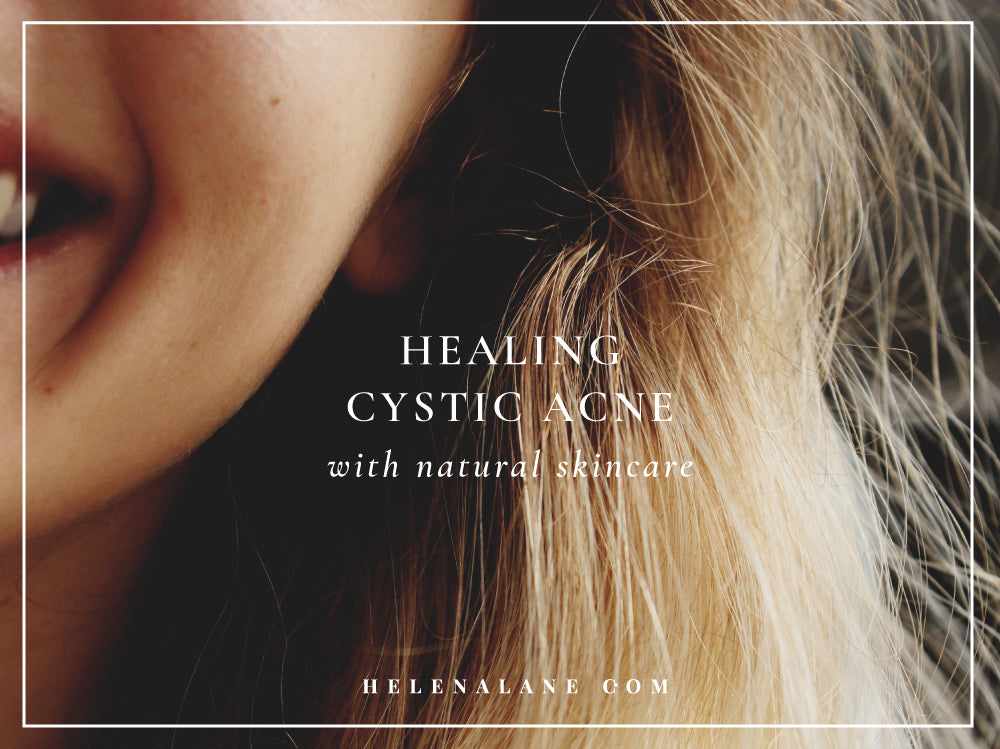 Healing Cystic Acne with Natural Skincare